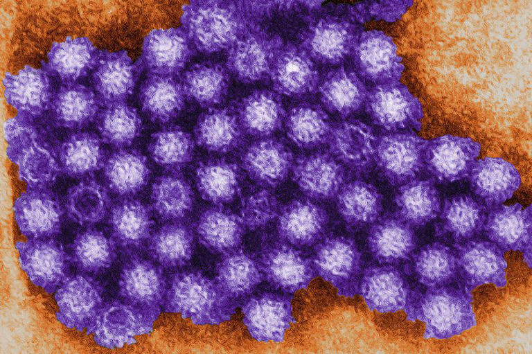 What Are Norovirus Symptoms? Quick Relief Guide