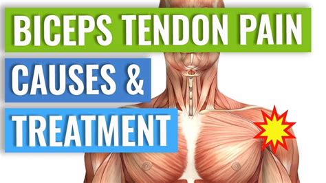 What Causes Bicep Tendonitis? Relief Exercises Inside