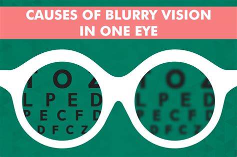 What Causes Blurry Vision? Eye Doctor Louisville Ky Solutions