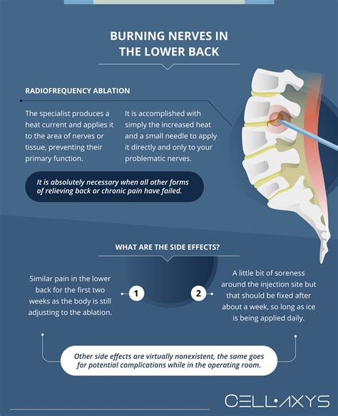 What Causes Burning Nerves? Lower Back Relief