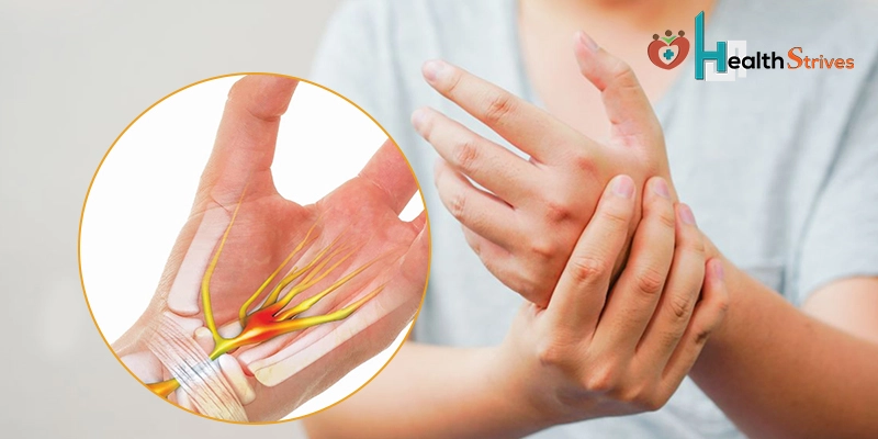 What Causes Carpal Tunnel? Easy Exercises Inside