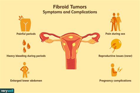 What Causes Fibroid Tumor? Effective Uterus Treatment