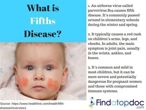 What Causes Fifth Disease? Natural Remedies Inside