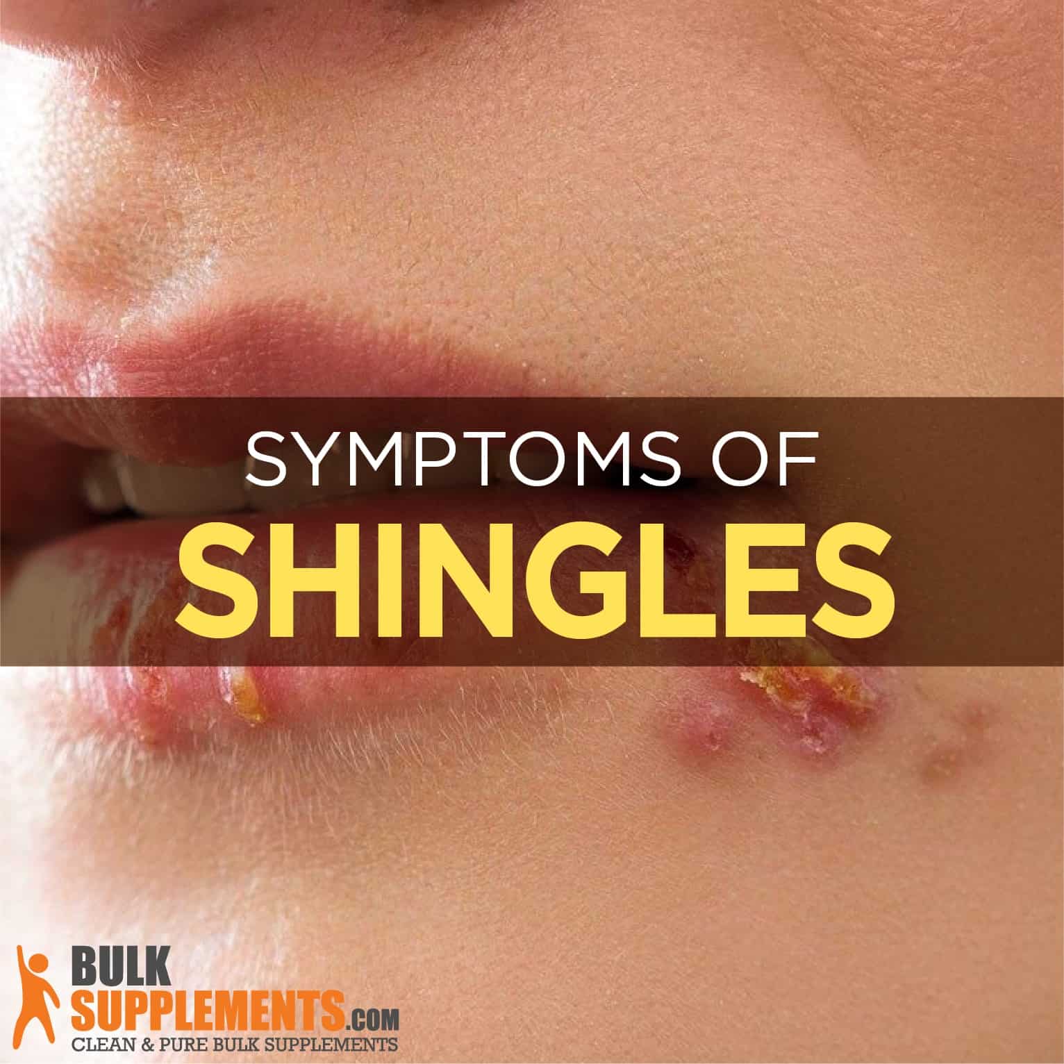 What Causes Shingles Inside Eye? Treatment Options