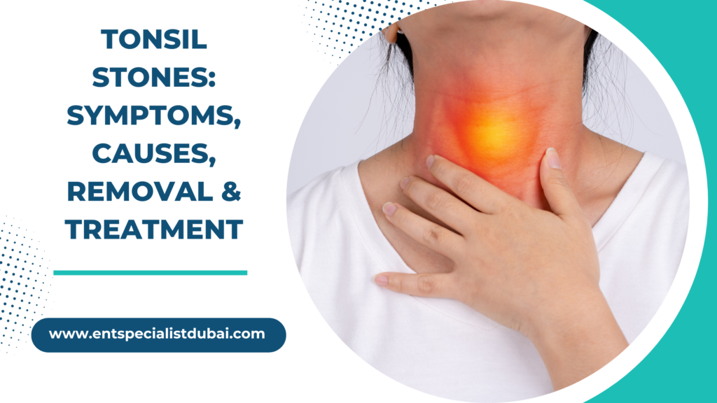 What Causes Tonsil Stones? Natural Removal Tips