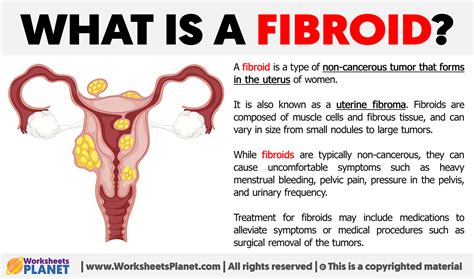 What Is A Fibroid