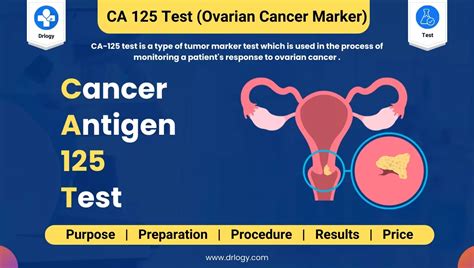 What Is A Good Ca125 Result What Is A Good Ca125 Result