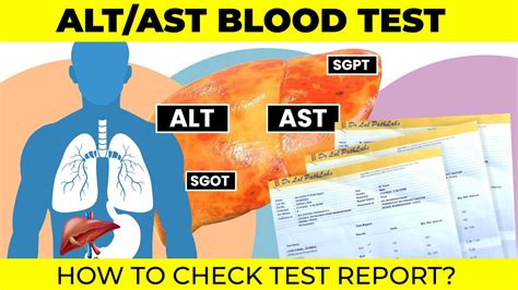 What Is Ast Blood Work