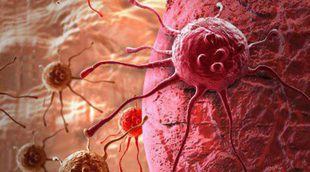 What Is Cancer Antigen 125? Understanding Your Results