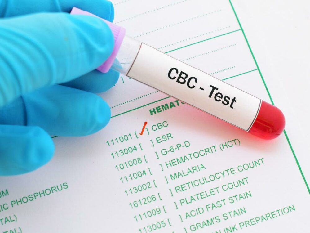 What Is Cbc Blood Test