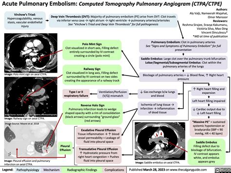 What Is Computed Tomography Angiography? A Diagnostic Guide