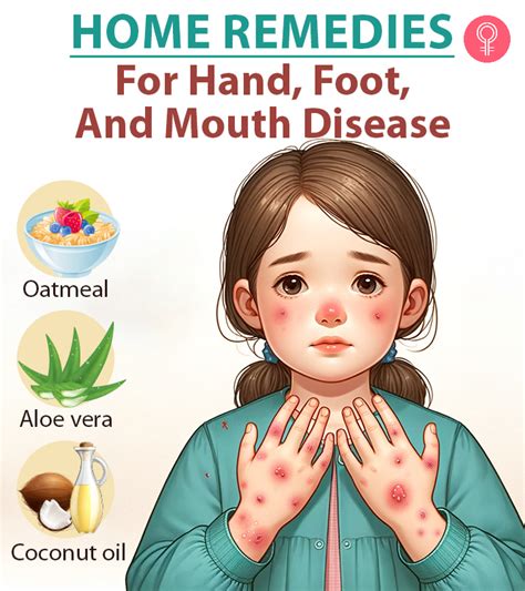 What Is Hands Feet Mouth Disease? Quick Remedies