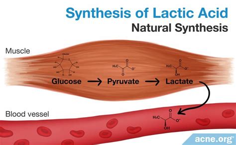 What Is Lactic Acid