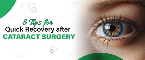 What's Cataract Surgery Recovery Time? Quick Healing Tips