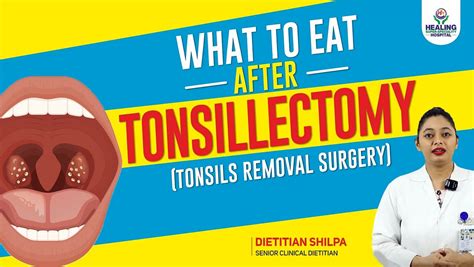 When Can I Eat Normally After Tonsil Removal? Recovery Guide