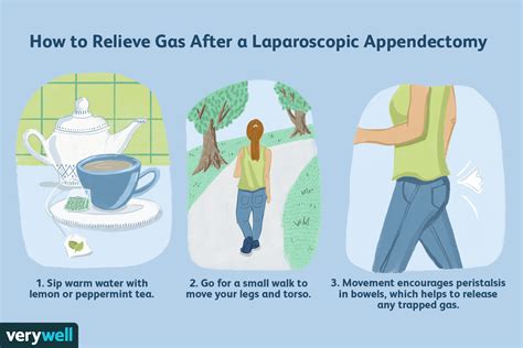 When Can I Return To Work After Appendix Surgery?