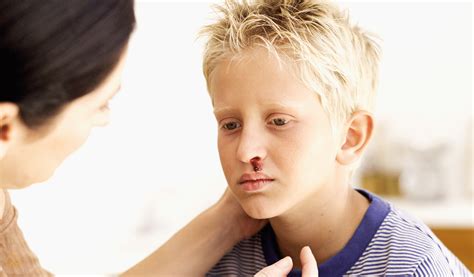When Do Kids Outgrow Nose Bleeds? Expert Solutions