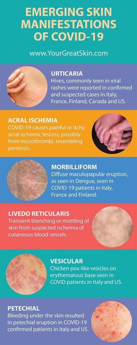 When Does Covid Rash Appear? Early Signs & Care