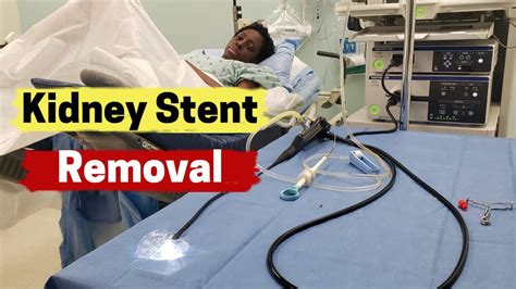 When Is Kidney Stent Removal Necessary? Expert Advice