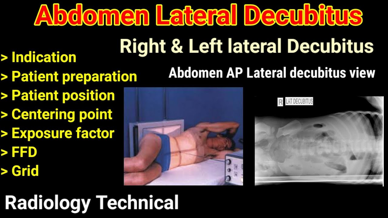 X Ray Of Abdomen: Get Accurate Injury Detection